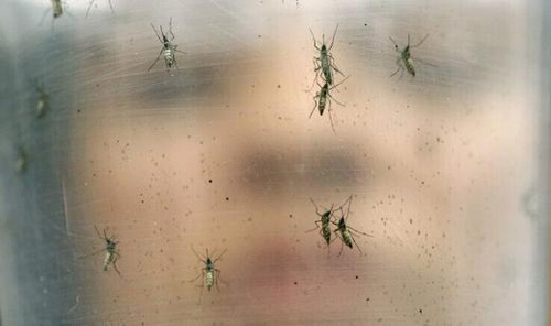 顱內(nèi)多普勒